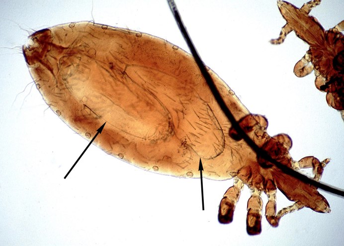 Linognathus setosus