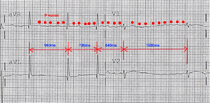 3.7 EKG цилиндры