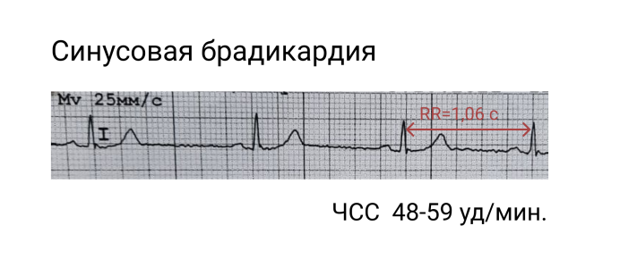 Островная (серая) лисица