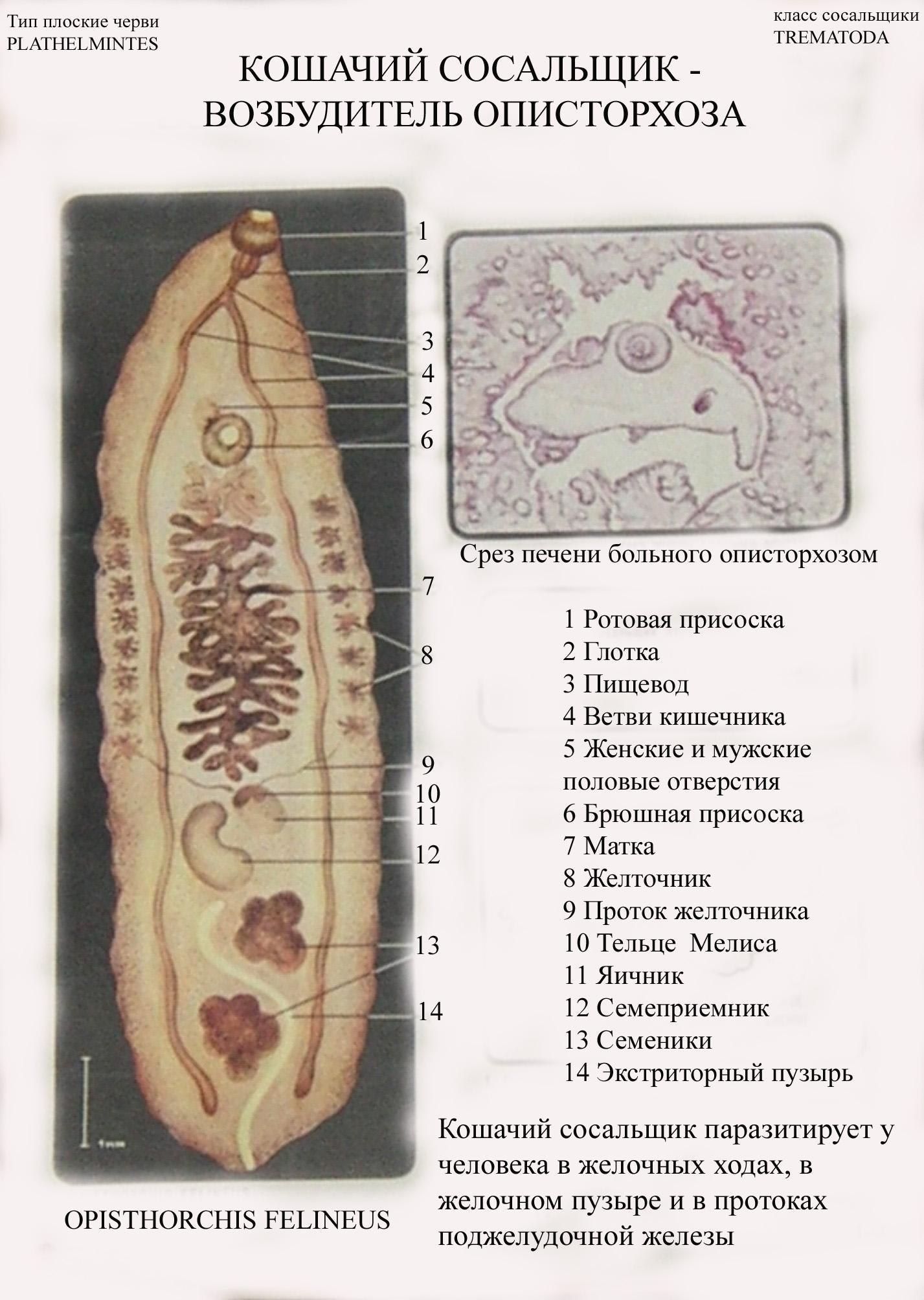 ЭРХПГ. Печеночная двуустка (Fasciola hepatica)