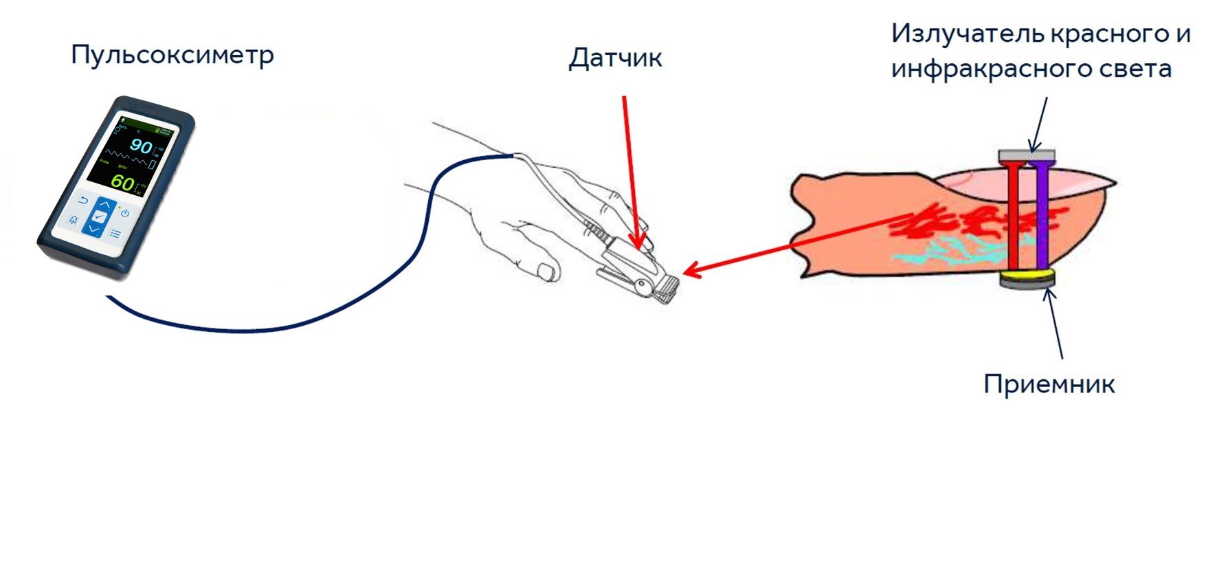 Метод сатурации