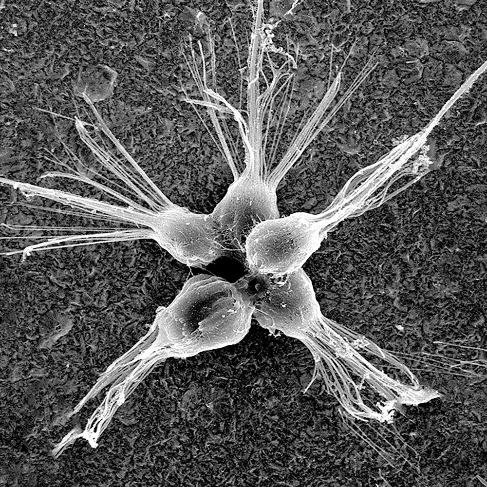 Хоанофлагелляты Амебозои