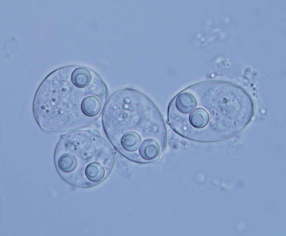 Миксоспоридии (Myxozoa)