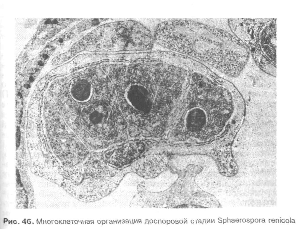 Миксоспоридия sphaerospora renicola