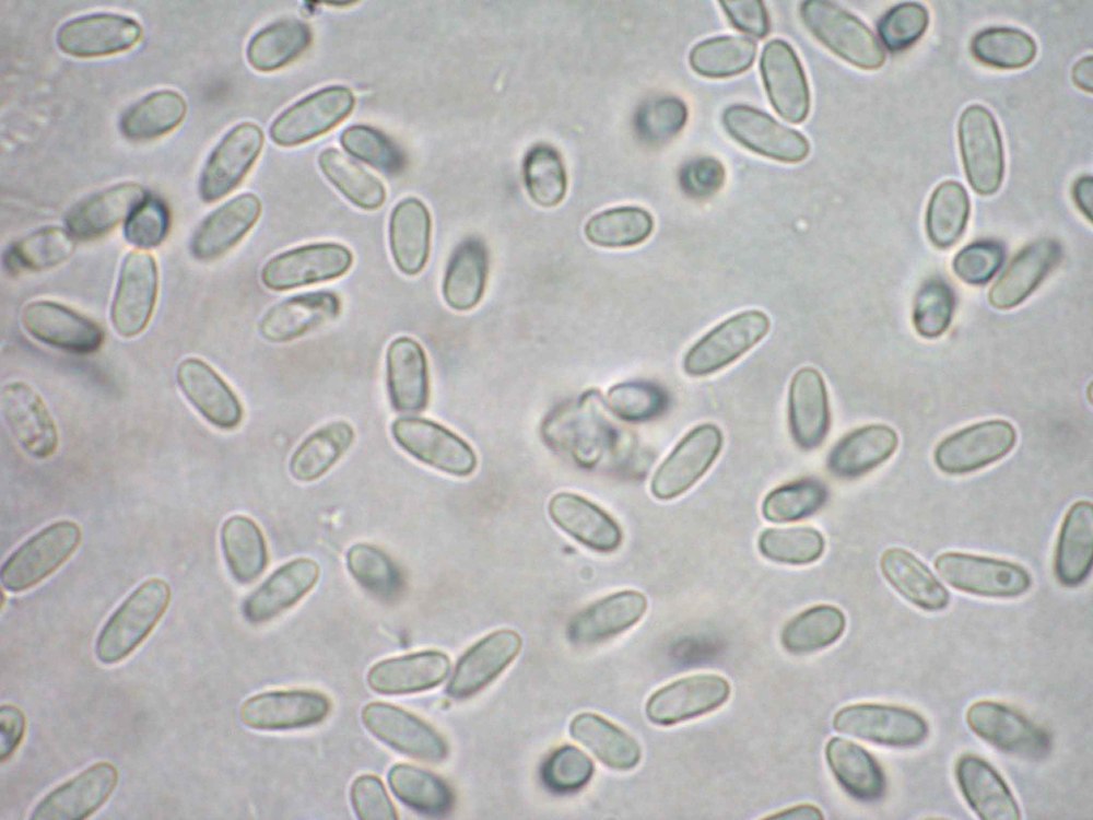 Glugea Microsporidium