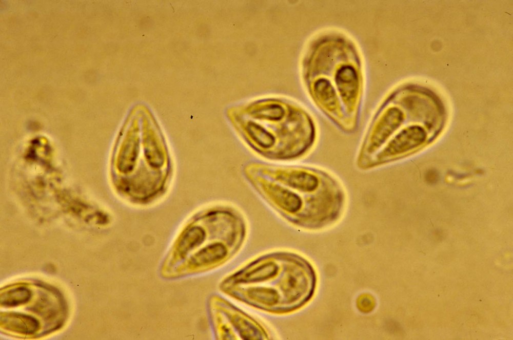 Паразиты Myxozoa