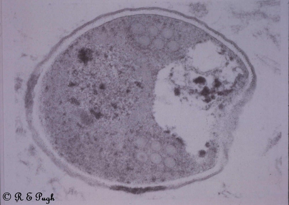 Microsporidia грибы