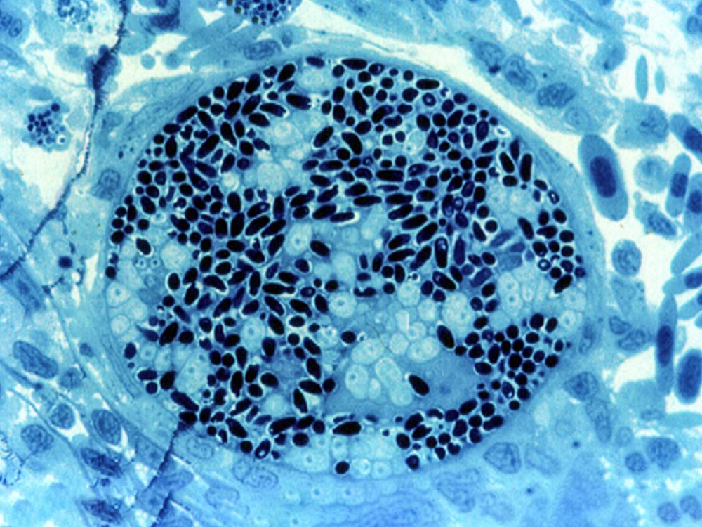 Тип микроспоридии (microspora)