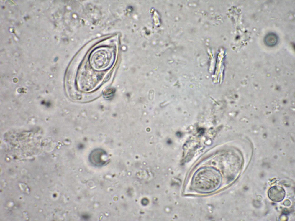 Myxobolus pyriformis