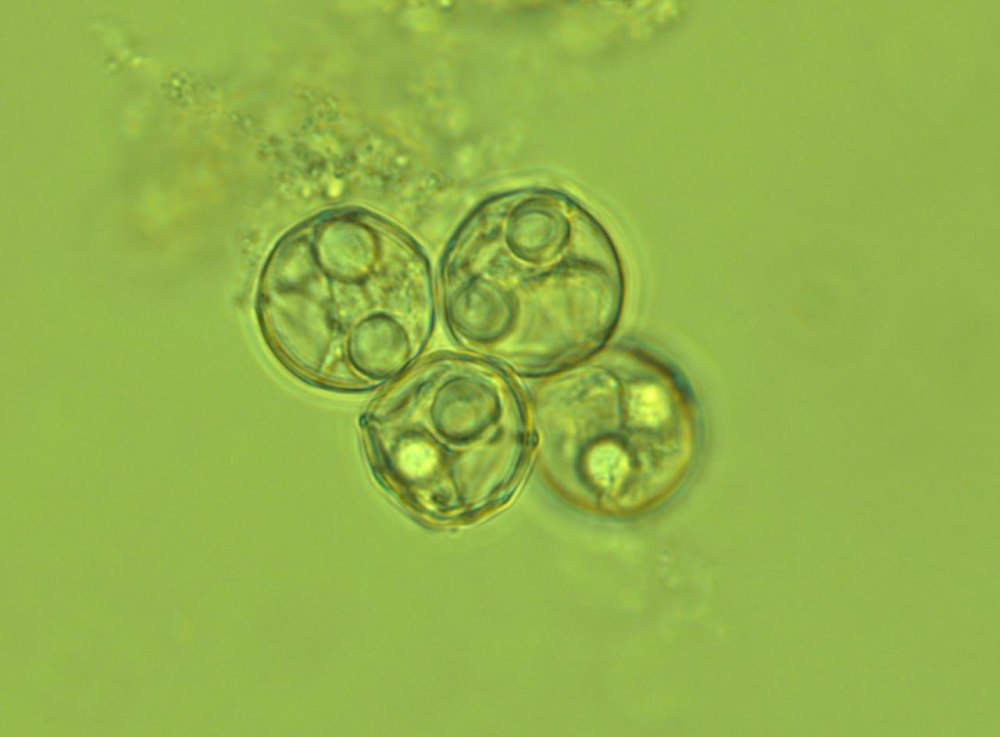 Ксоспоридии Споровики