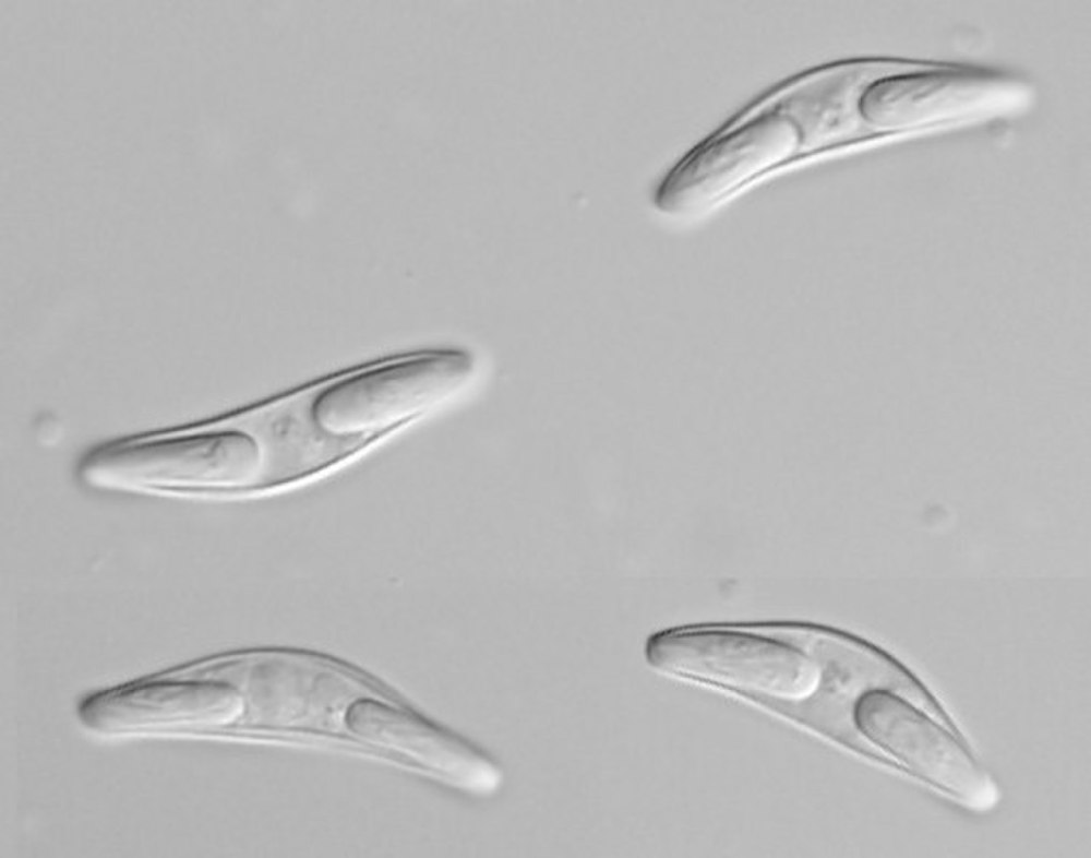 Myxozoa представители