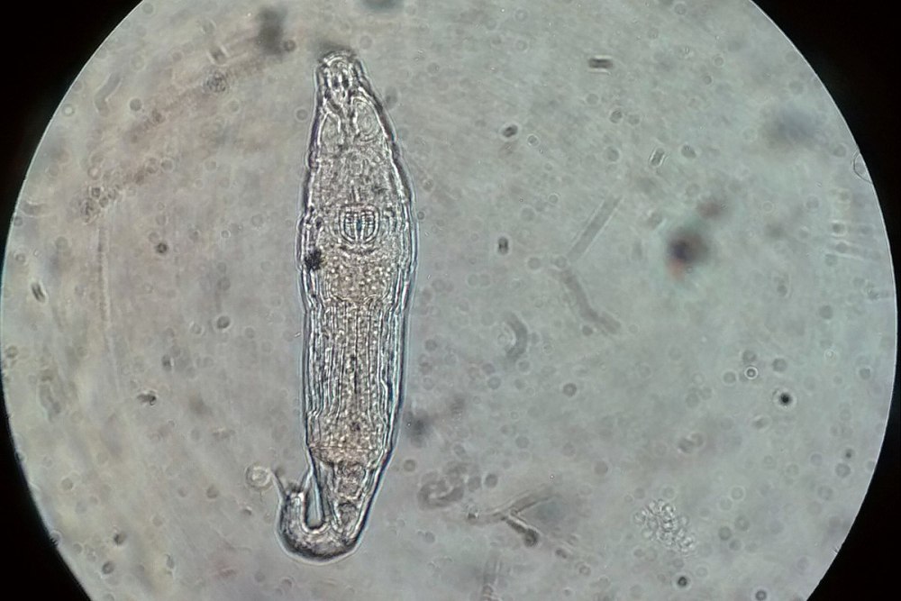 Philodina megalotrocha