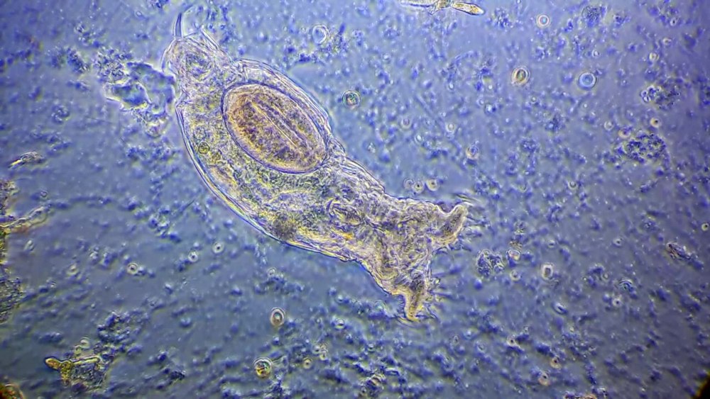 Bdelloidea коловратки