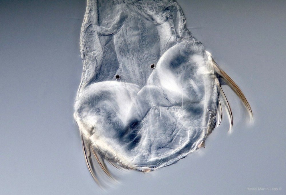 Parasagitta elegans