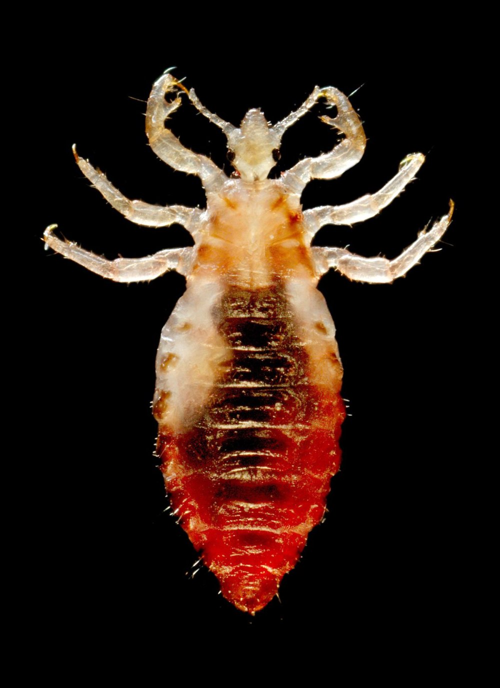 Головная вошь (Pediculus humanus capitis)