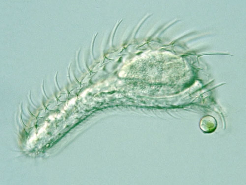 Gastrotricha (Gastrotricha),