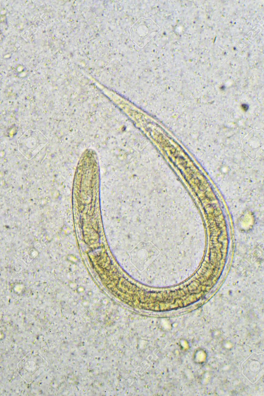 Стронгилоидоз лошадей. Strongyloides stercoralis. Паразиты strongyloides stercoralis, necator americanus. Strongyloides stercoralis яйца. Стронгилоидоз стерколарис.