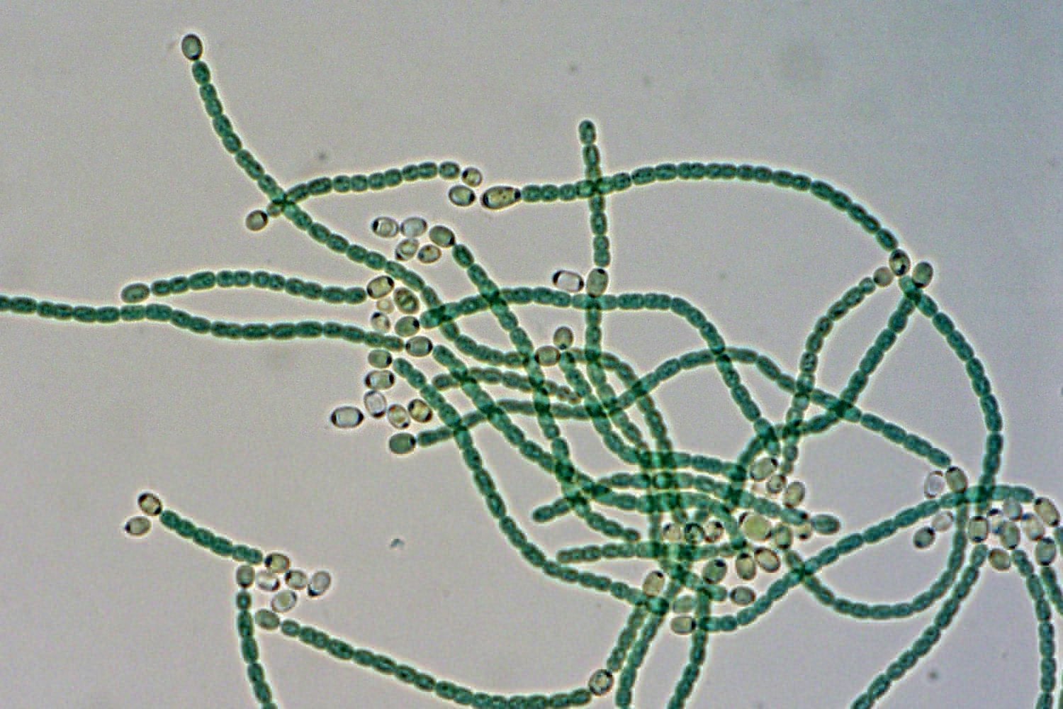 Клетки водорослей и цианобактерий. Цианобактерия Анабена. Носток цианобактерия. Цианобактерии строение клетки. Цианобактерии и актиномицеты.