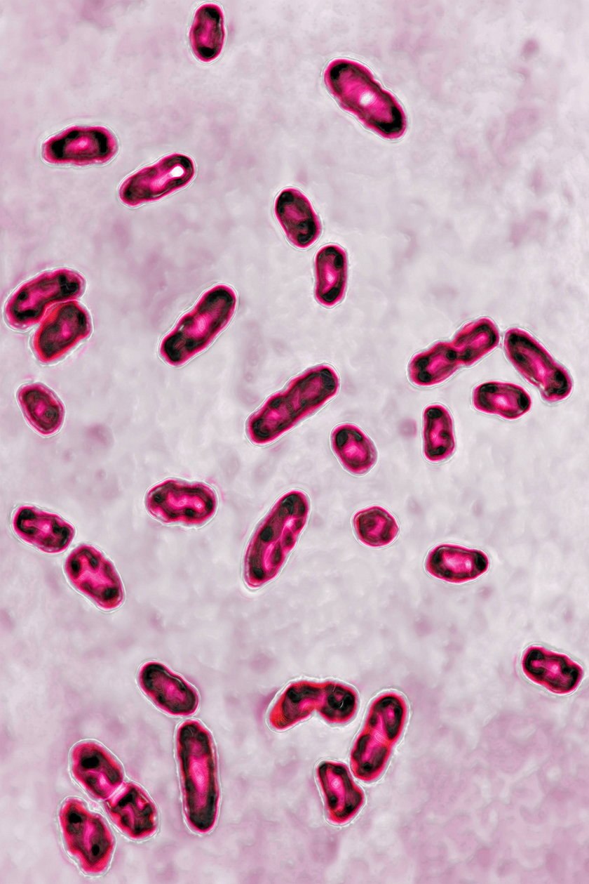 Чума возбудитель (Yersinia pestis)