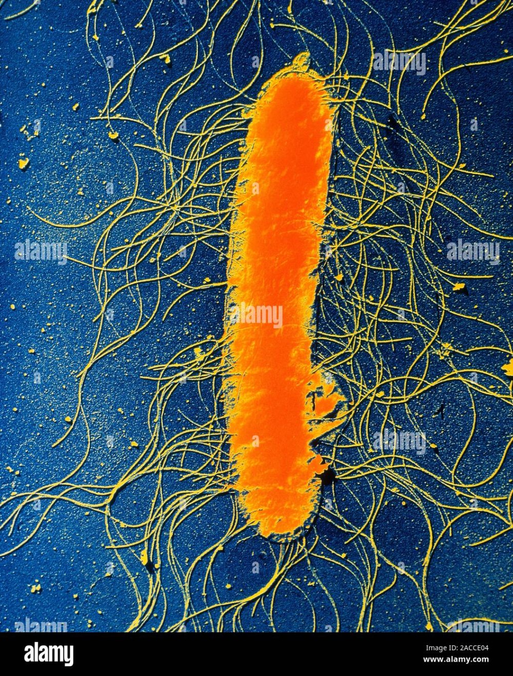 Proteus vulgaris (палочка протея)