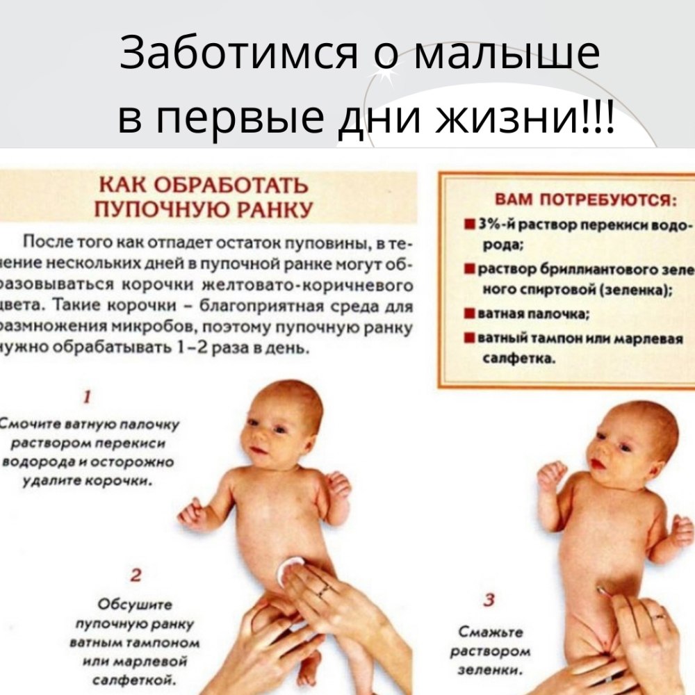 Омфалит обработка пупочной ранки алгоритм