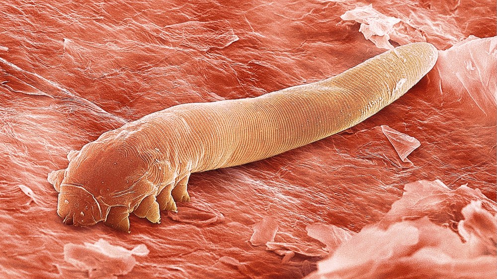 Клещ угревая Железница