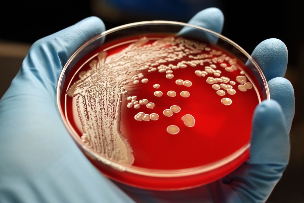MRSA стрептококк