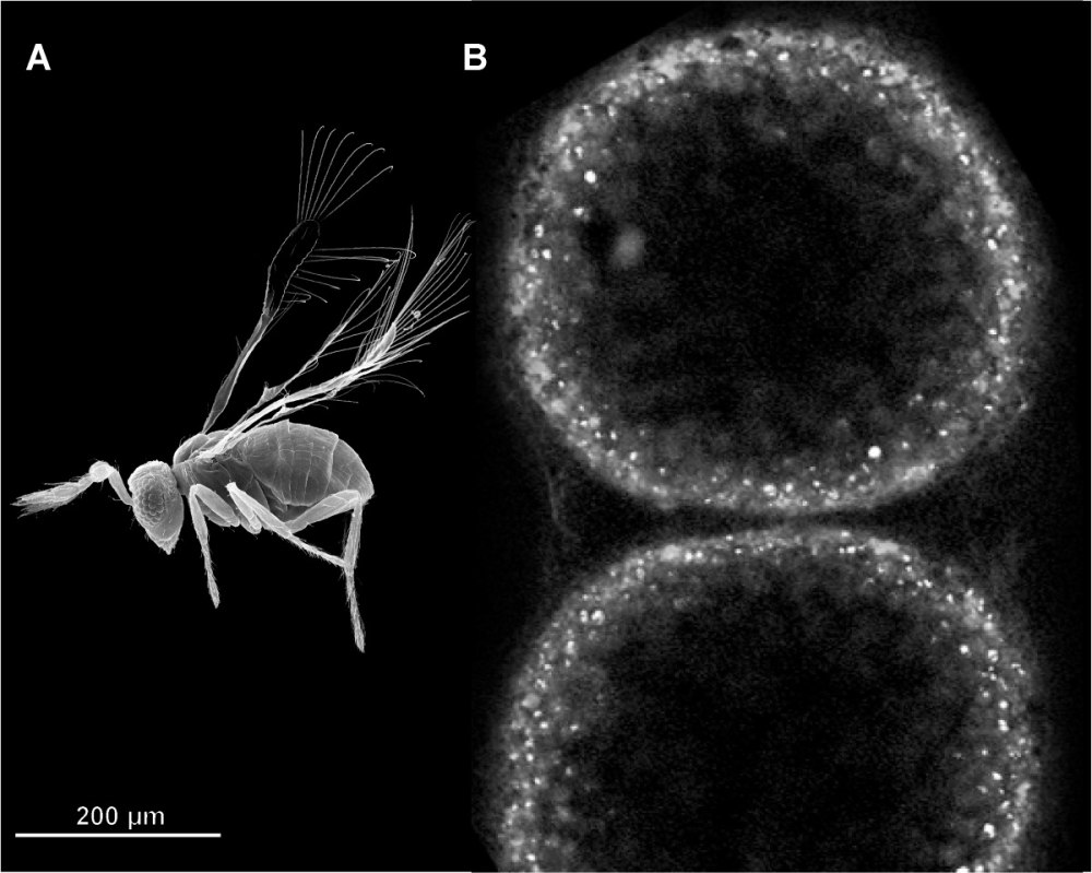 Thiomargarita namibiensis