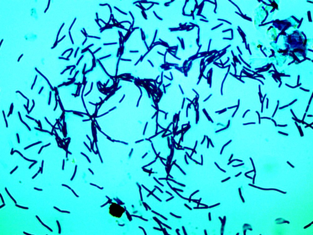 Actinomyces israelii морфология