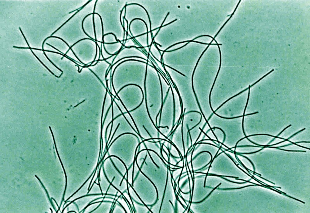 Chloroflexus aurantiacus