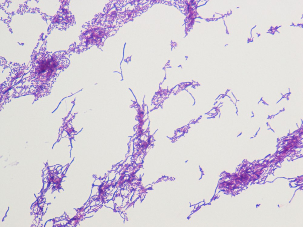 Актиномицеты Streptomyces