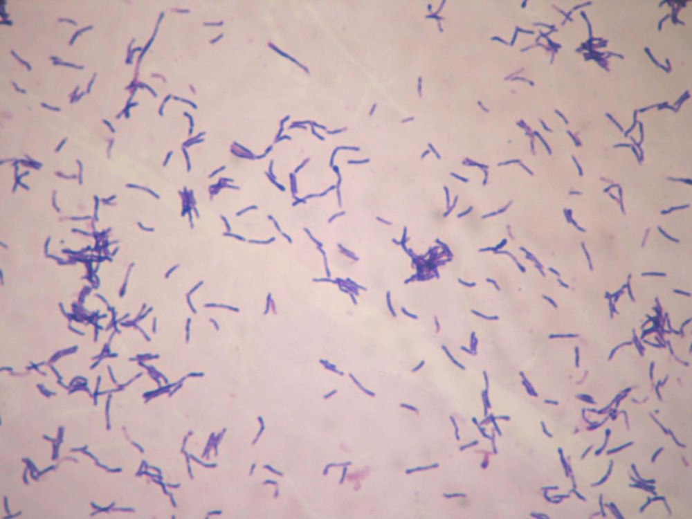 Actinomyces микроскопия