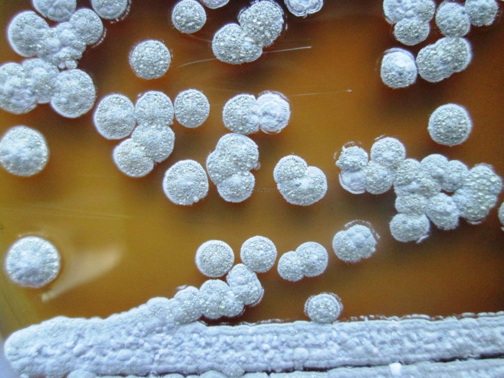 Streptomyces griseus