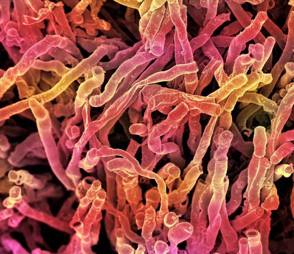 Actinomyces griseus возбудитель