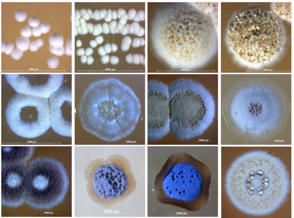 Actinomycetes Comitans микробиология