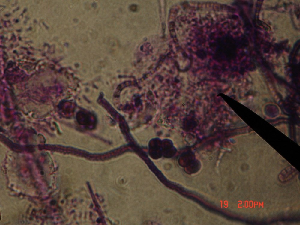 Гриб actinomyces Bovis