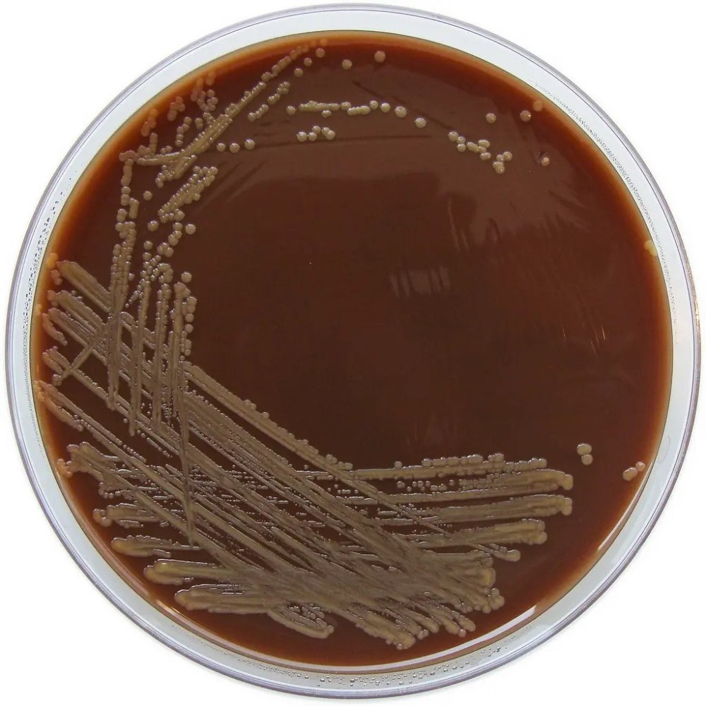 Шоколадный агар (h. influenza