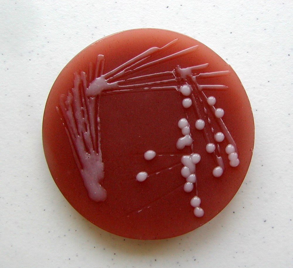 Haemophilus influenzae питательные среды