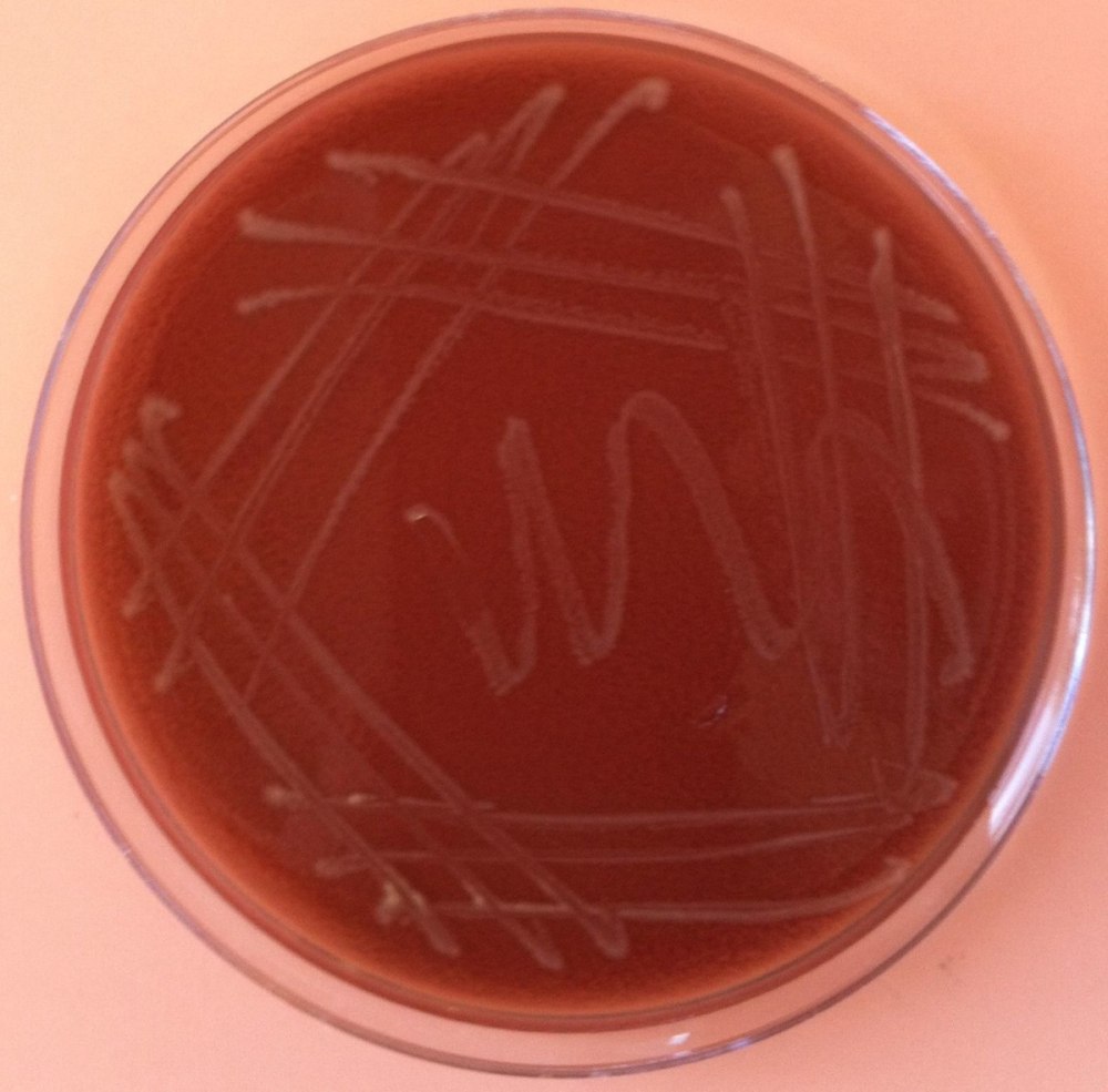 Haemophilus influenzae на шоколадном агаре
