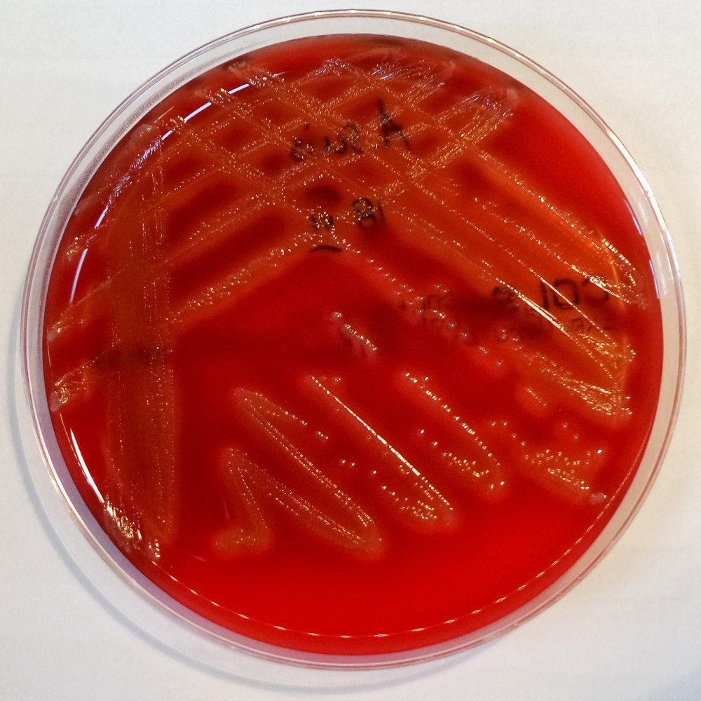Actinobacillus actinomycetemcomitans