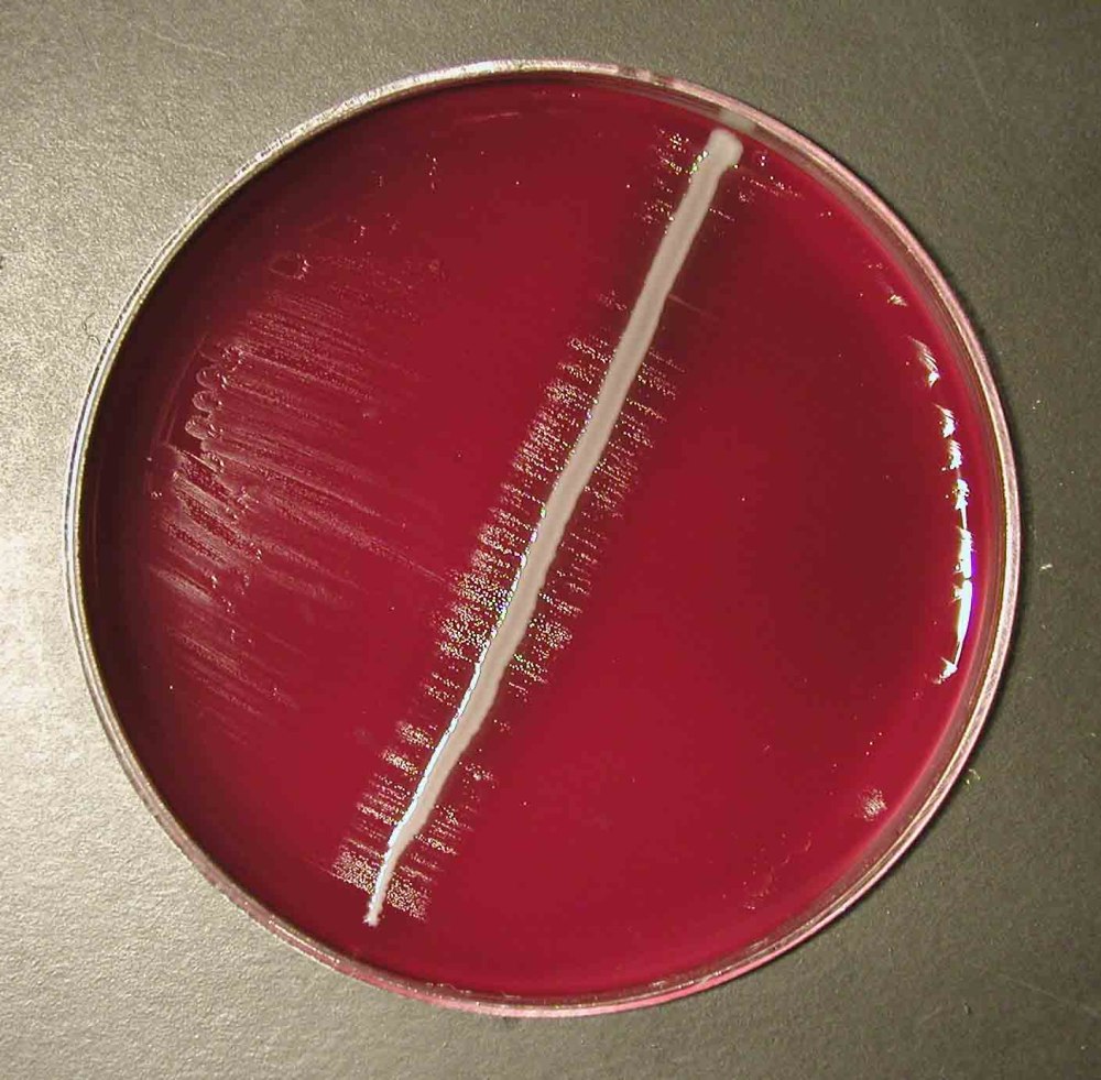 Haemophilus influenzae колонии