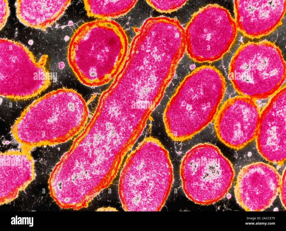 Бактерии Haemophilus influenzae