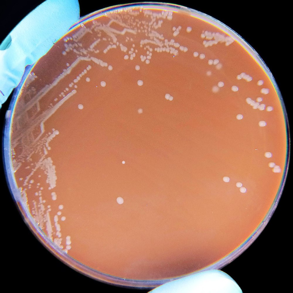 Haemophilus influenzae аэроб