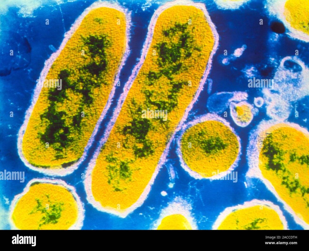 Бактерии Haemophilus influenzae