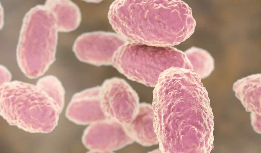 Коклюш Bordetella pertussis (бордетелла пертуссис)