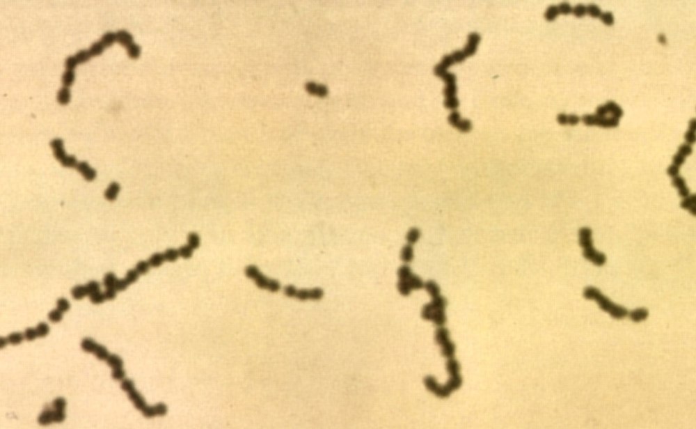 Клетки бактерий рода Streptococcus
