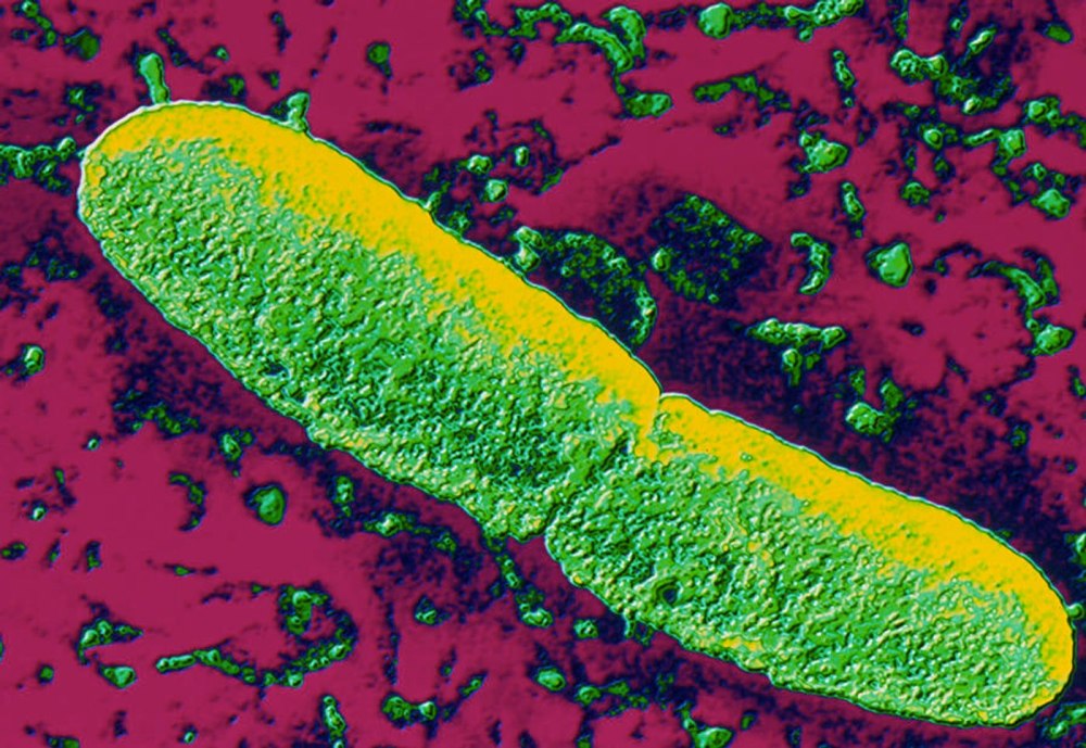 Бактерия Yersinia pestis возбудитель
