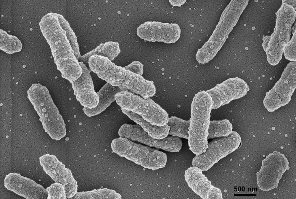 Yersinia pestis чумная палочка