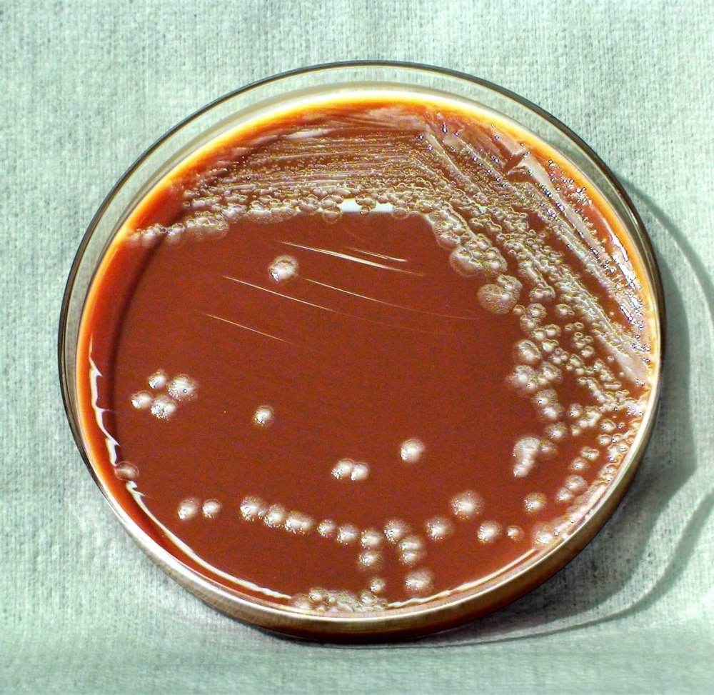 Бактерии иерсинии