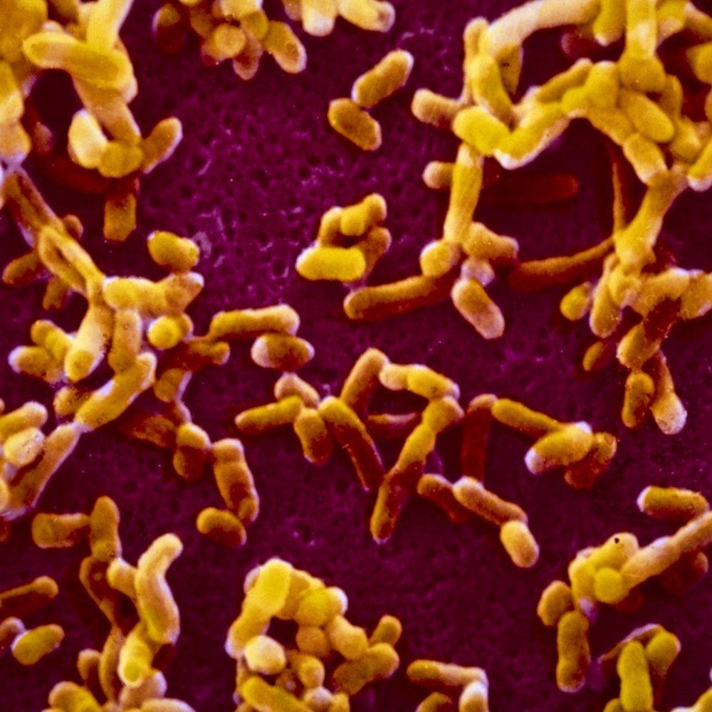 Yersinia pestis чумная палочка